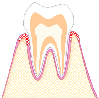 あさみ歯科クリニック｜歯周病