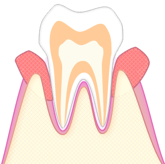 あさみ歯科クリニック｜歯周病