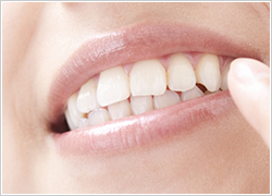 セラミック治療|あさみ歯科クリニック