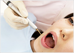 歯周病の原因|あさみ歯科クリニック
